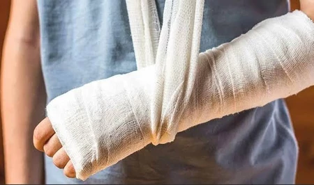 В Баку в результате падения дерева из-за сильного ветра пострадал человек