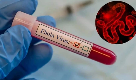 Вирус Эбола может распространиться в Европу и Азию
