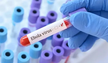 Во Франции зафиксирован первый случай заражения вирусом Эбола