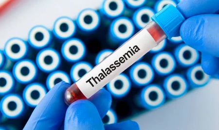 В Азербайджане официально зарегистрированы 3 190 пациентов с талассемией
