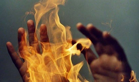 В Гёйгёльском районе мужчина поджег супругу после бытовой ссоры
